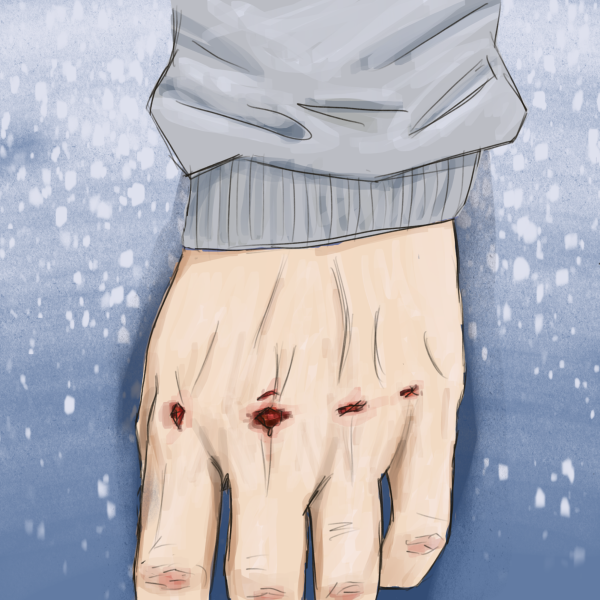 Split Knuckles